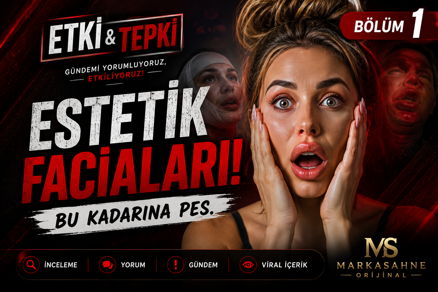 Estetik Faciaları: Bu Kadarı Pes!